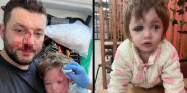 Karamürsel Komşusunda Vahşet Kucağındaki Bebekle Odunlu Saldırıya Uğradı